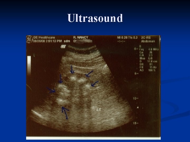 Ultrasound 