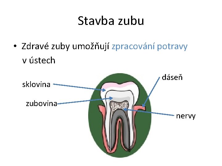 Stavba zubu • Zdravé zuby umožňují zpracování potravy v ústech sklovina dáseň zubovina nervy