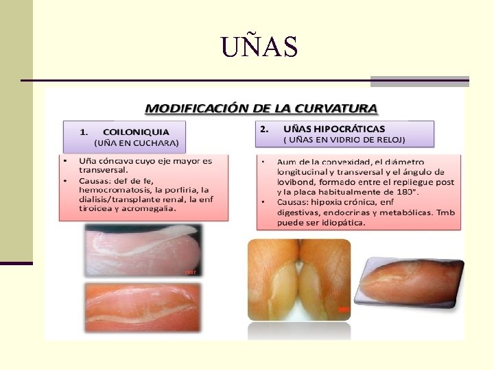UÑAS UÑAS