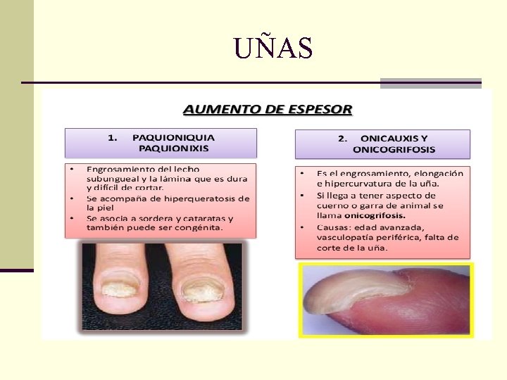 UÑAS UÑAS