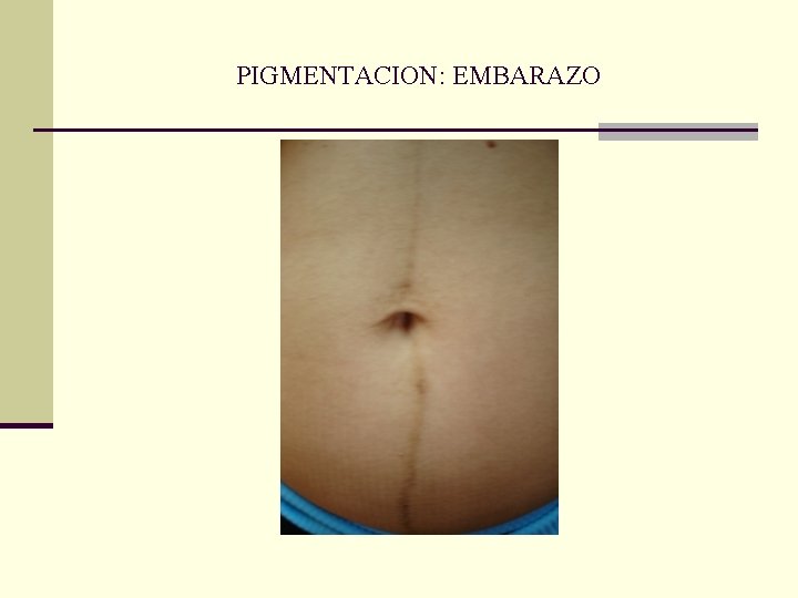 PIGMENTACION: EMBARAZO PIGMENTACION: EMBARAZO