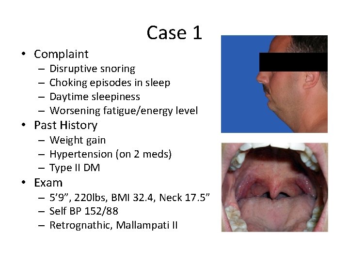 Case 1 • Complaint – – Disruptive snoring Choking episodes in sleep Daytime sleepiness