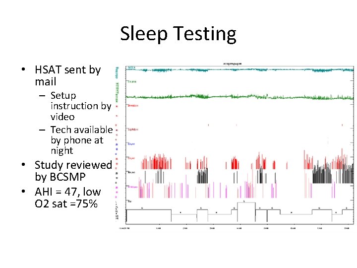 Sleep Testing • HSAT sent by mail – Setup instruction by video – Tech