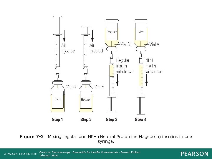 Figure 7 -5 Mixing regular and NPH (Neutral Protamine Hagedorn) insulins in one syringe.