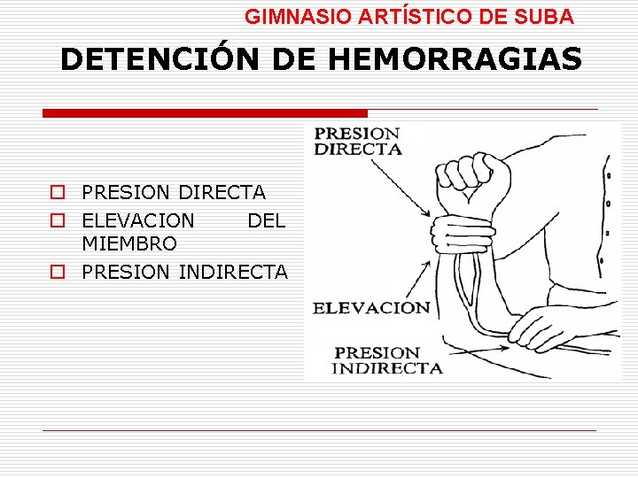GIMNASIO ARTÍSTICO DE SUBA DETENCIÓN DE HEMORRAGIAS o PRESION DIRECTA o ELEVACION DEL MIEMBRO