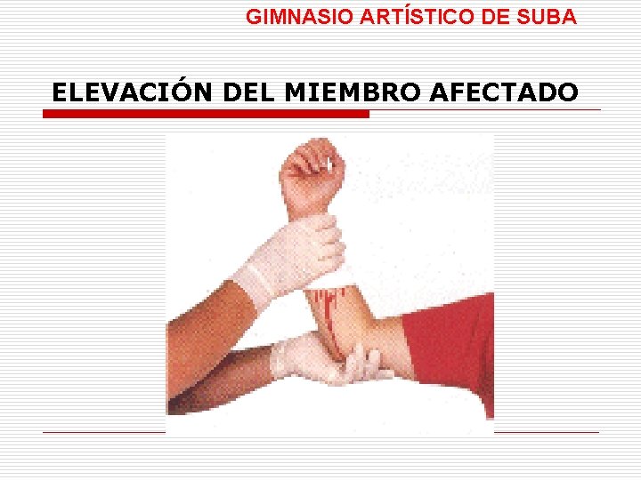 GIMNASIO ARTÍSTICO DE SUBA ELEVACIÓN DEL MIEMBRO AFECTADO 