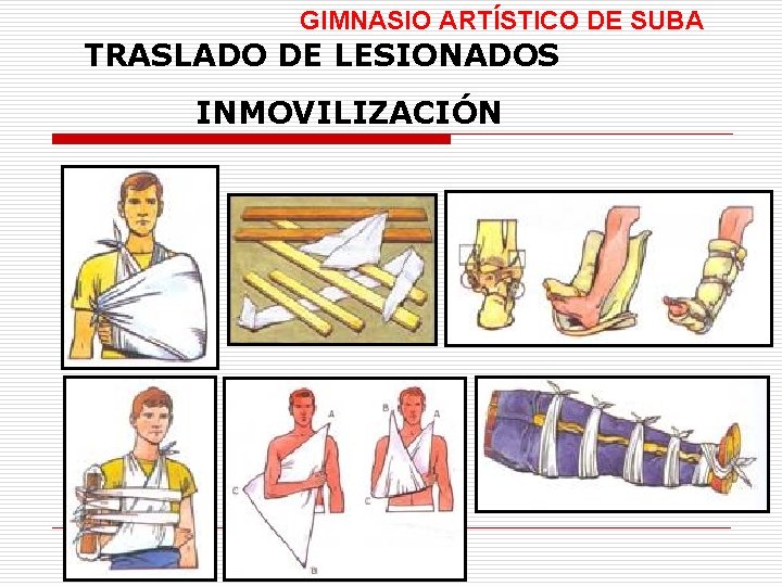 GIMNASIO ARTÍSTICO DE SUBA TRASLADO DE LESIONADOS INMOVILIZACIÓN 