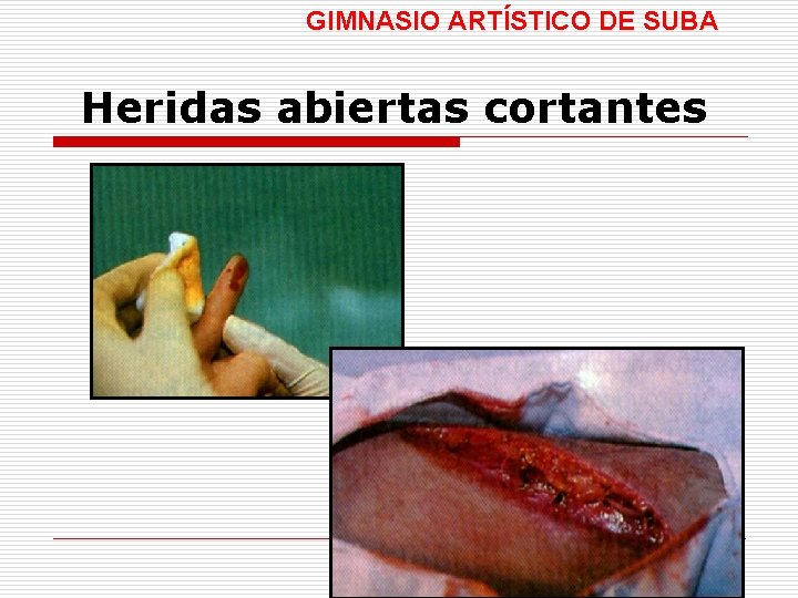 GIMNASIO ARTÍSTICO DE SUBA Heridas abiertas cortantes 