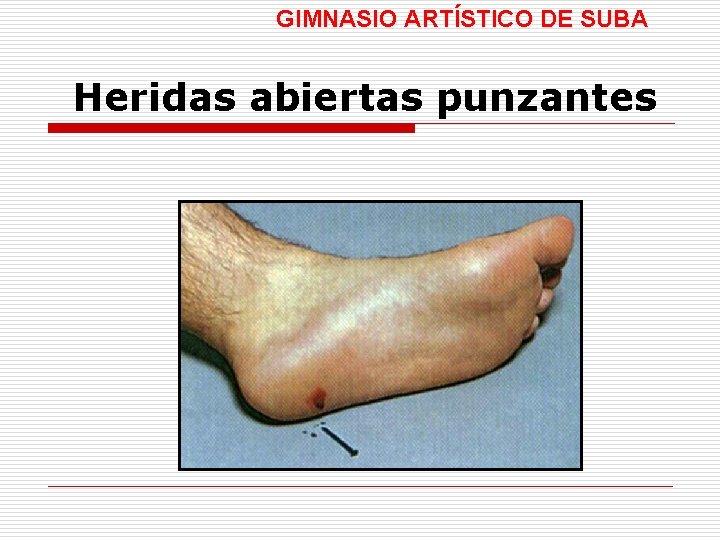 GIMNASIO ARTÍSTICO DE SUBA Heridas abiertas punzantes 
