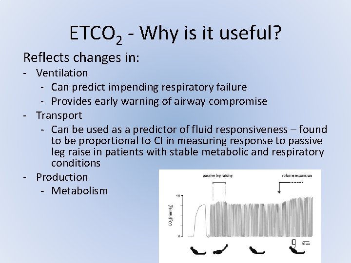 ETCO 2 - Why is it useful? Reflects changes in: - Ventilation - Can ETCO 2 - Why is it useful? Reflects changes in: - Ventilation - Can