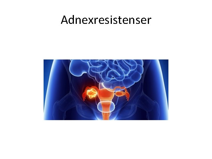 Adnexresistenser 