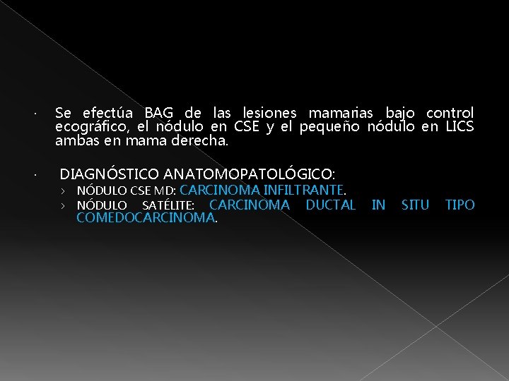  Se efectúa BAG de las lesiones mamarias bajo control ecográfico, el nódulo en