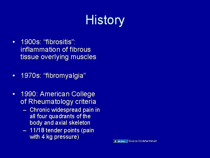 History • 1900 s: “fibrositis”: inflammation of fibrous tissue overlying muscles • 1970 s: