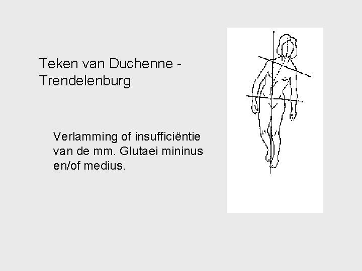 Teken van Duchenne Trendelenburg Verlamming of insufficiëntie van de mm. Glutaei mininus en/of medius.