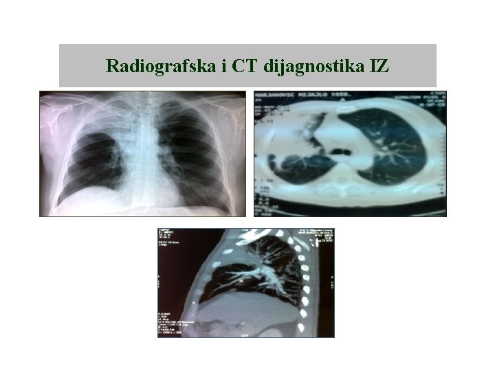 Radiografska i CT dijagnostika IZ 