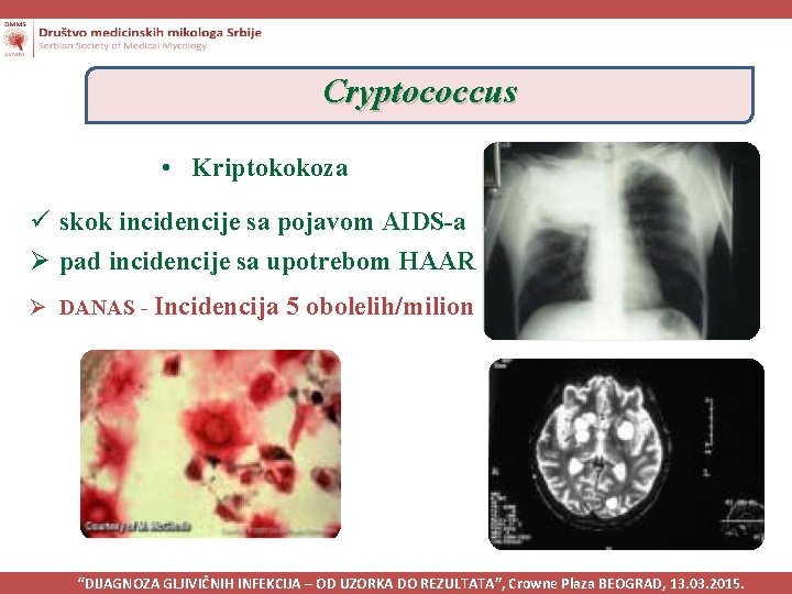 Cryptococcus • Kriptokokoza ü skok incidencije sa pojavom AIDS-a Ø pad incidencije sa upotrebom