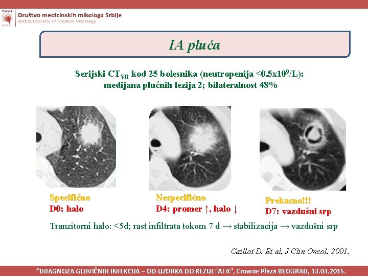 IA pluća Serijski CTVR kod 25 bolesnika (neutropenija <0. 5 x 109/L): medijana plućnih