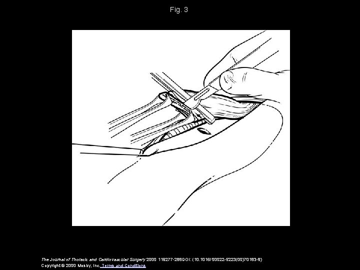 Fig. 3 The Journal of Thoracic and Cardiovascular Surgery 2000 119277 -288 DOI: (10.