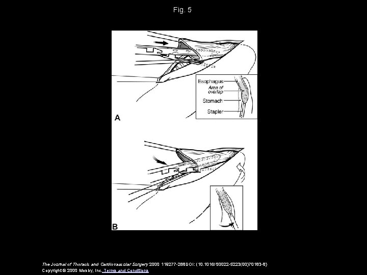 Fig. 5 The Journal of Thoracic and Cardiovascular Surgery 2000 119277 -288 DOI: (10.