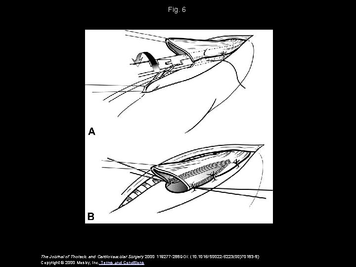 Fig. 6 The Journal of Thoracic and Cardiovascular Surgery 2000 119277 -288 DOI: (10.