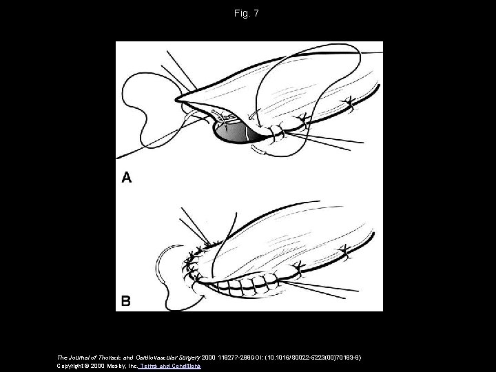 Fig. 7 The Journal of Thoracic and Cardiovascular Surgery 2000 119277 -288 DOI: (10.