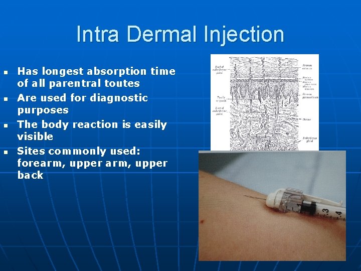 Intra Dermal Injection n n Has longest absorption time of all parentral toutes Are