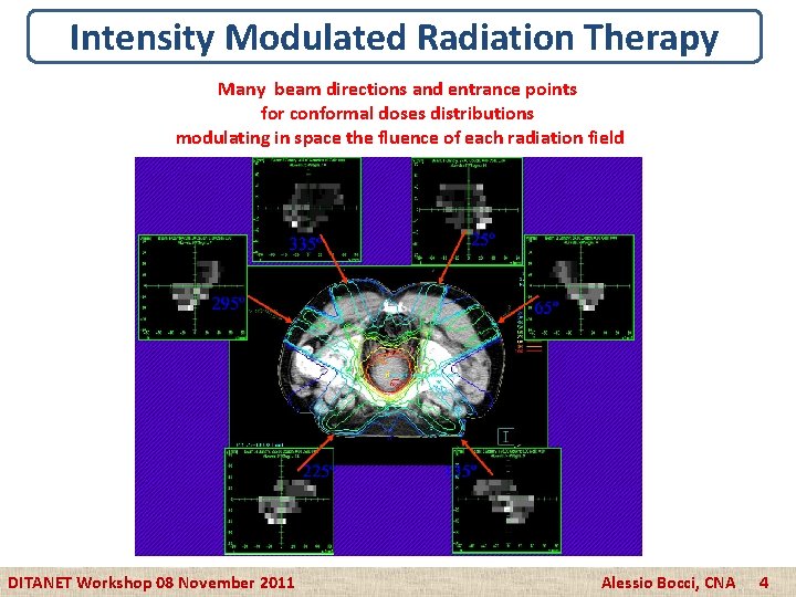 Intensity Modulated Radiation Therapy Many beam directions and entrance points for conformal doses distributions