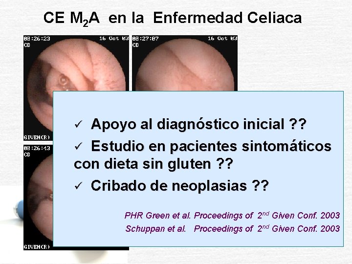 CE M 2 A en la Enfermedad Celiaca Apoyo al diagnóstico inicial ? ?