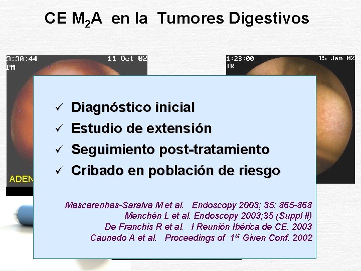 CE M 2 A en la Tumores Digestivos ü ü Diagnóstico inicial Estudio de