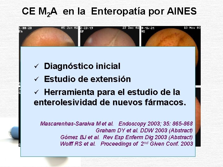 CE M 2 A en la Enteropatía por AINES Diagnóstico inicial ü Estudio de