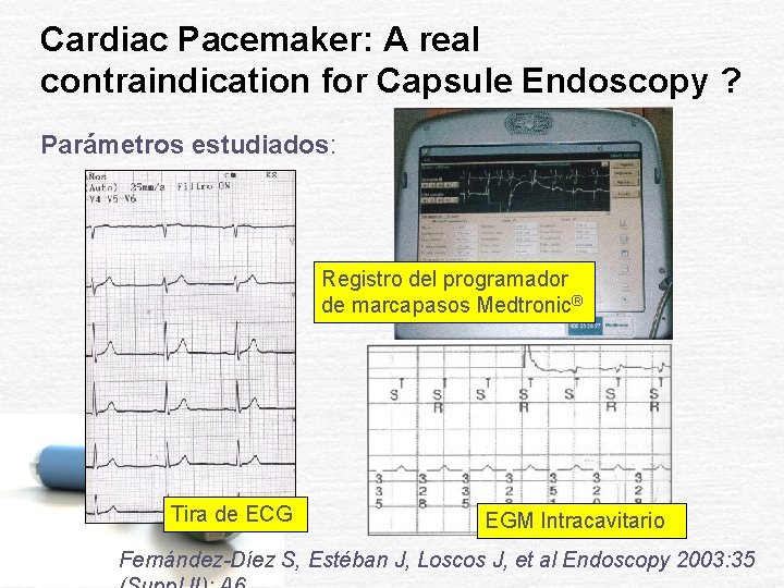 Cardiac Pacemaker: A real contraindication for Capsule Endoscopy ? Parámetros estudiados: Registro del programador