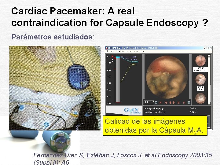 Cardiac Pacemaker: A real contraindication for Capsule Endoscopy ? Parámetros estudiados: Calidad de las