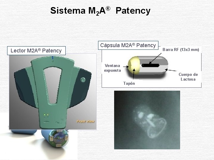 Sistema M 2 A® Patency Lector M 2 A® Patency Cápsula M 2 A®