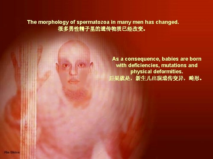 The morphology of spermatozoa in many men has changed. 很多男性精子里的遗传物质已经改变。 As a consequence, babies
