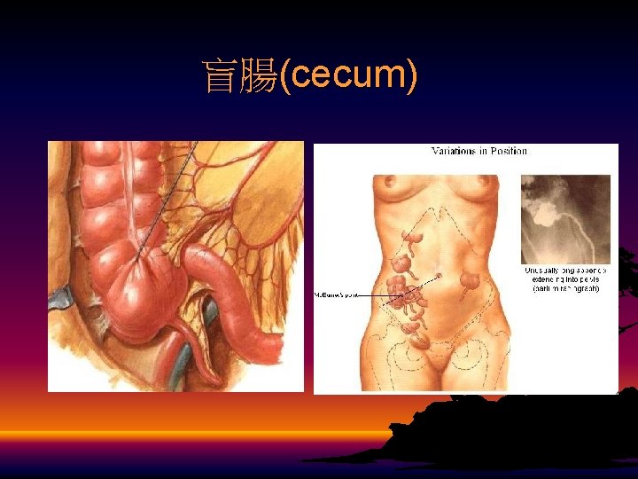 盲腸(cecum) 