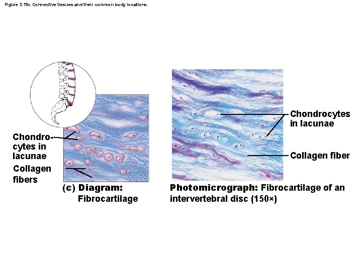 Figure 3. 19 c Connective tissues and their common body locations. Chondrocytes in lacunae