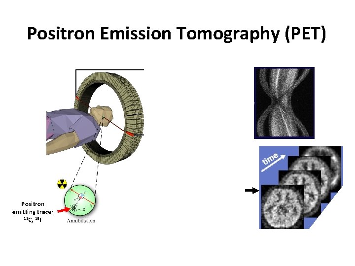 Positron Emission Tomography (PET) Positron emitting tracer 11 C, 18 F Positron Emission Tomography (PET) Positron emitting tracer 11 C, 18 F