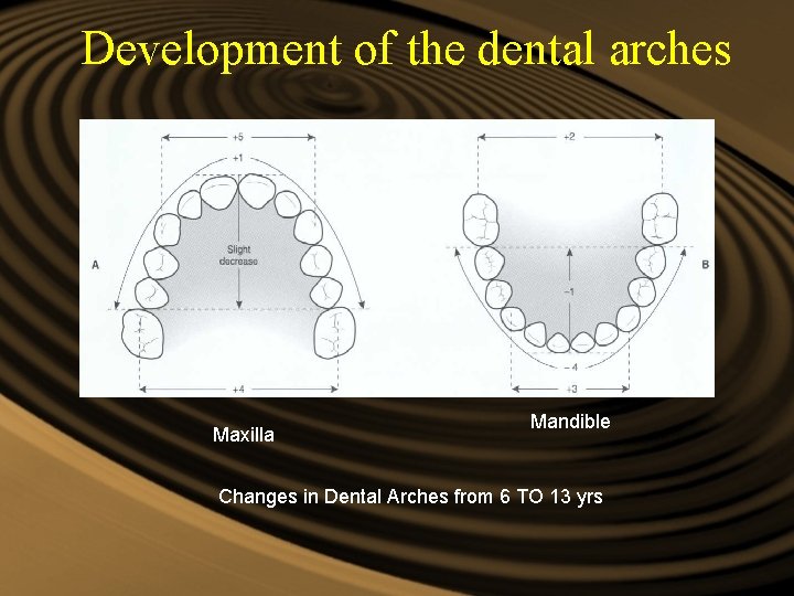 Development of the dental arches Maxilla Mandible Changes in Dental Arches from 6 TO Development of the dental arches Maxilla Mandible Changes in Dental Arches from 6 TO