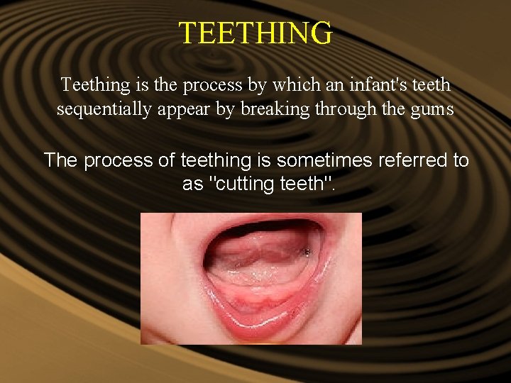 TEETHING Teething is the process by which an infant's teeth sequentially appear by breaking TEETHING Teething is the process by which an infant's teeth sequentially appear by breaking