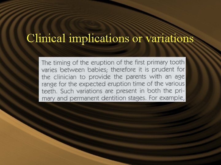 Clinical implications or variations Clinical implications or variations