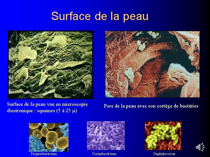 Surface de la peau vue en microscopie électronique : squames (5 à 25 µ)