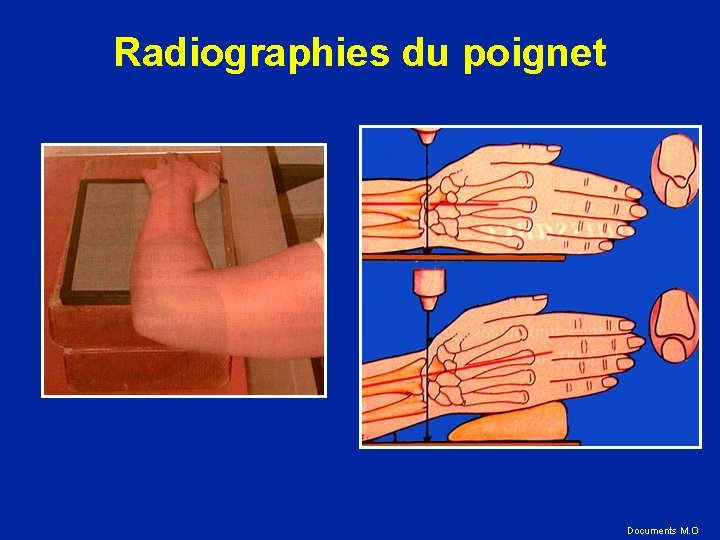 Radiographies du poignet Documents M. O 