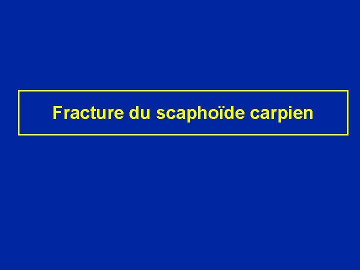 Fracture du scaphoïde carpien 