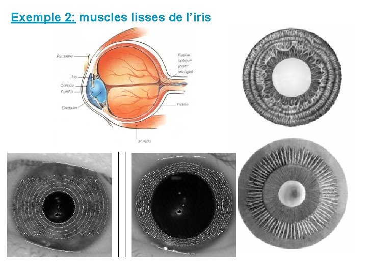Exemple 2: muscles lisses de l’iris 