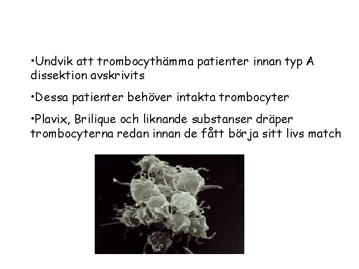  • Undvik att trombocythämma patienter innan typ A dissektion avskrivits • Dessa patienter