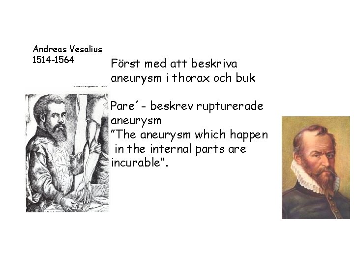 Andreas Vesalius 1514 -1564 Först med att beskriva aneurysm i thorax och buk Pare´-