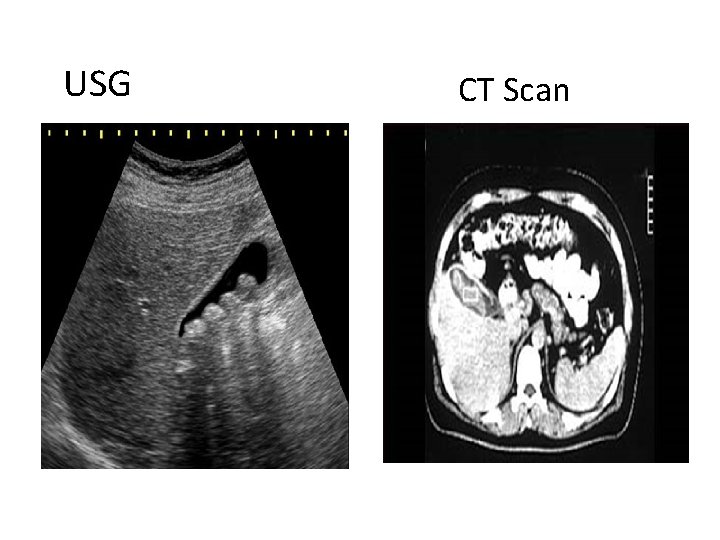 USG CT Scan 