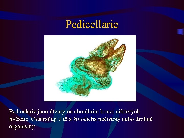 Pedicellarie Pedicelarie jsou útvary na aborálním konci některých hvězdic. Odstraňují z těla živočicha nečistoty