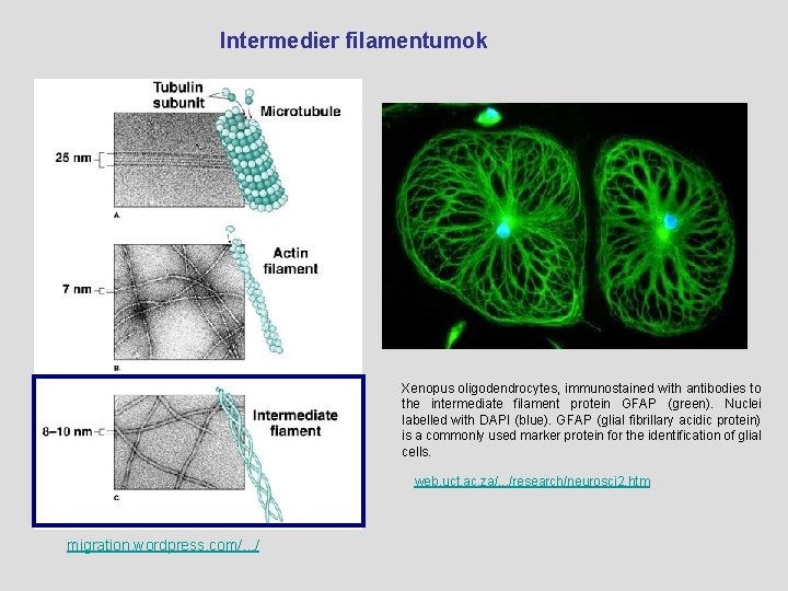  Intermedier filamentumok Xenopus oligodendrocytes, immunostained with antibodies to the intermediate filament protein GFAP