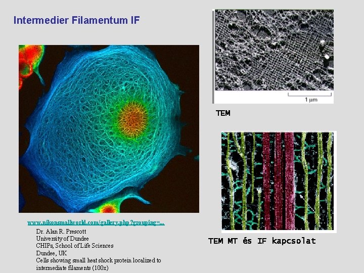 Intermedier Filamentum IF TEM www. nikonsmallworld. com/gallery. php? grouping=. . . Dr. Alan R.